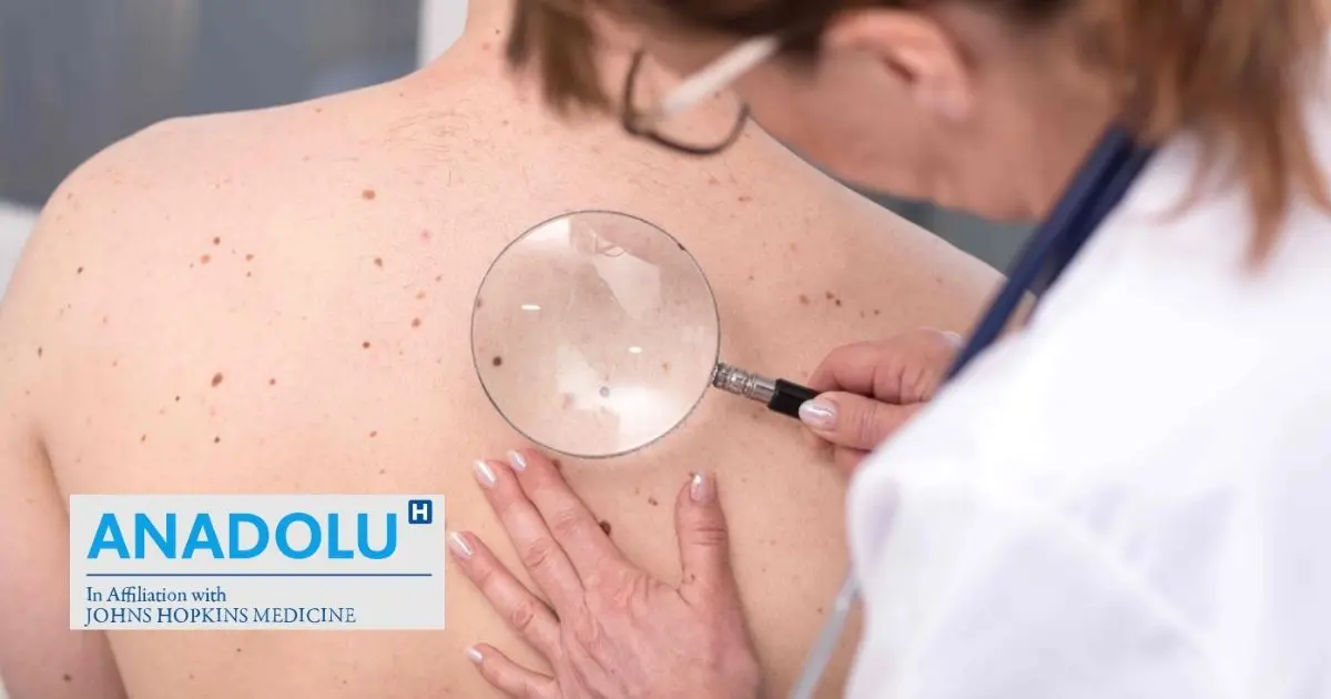 Face au cancer de la peau : Les avancées de la médecine et les traitements qui marchent