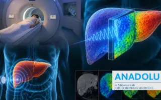 Foie malade : l&rsquo;élastographie par résonance magnétique, une alternative à la biopsie