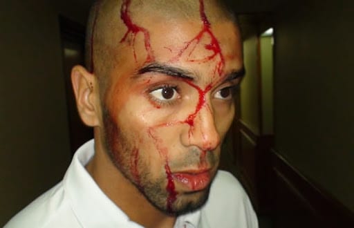 M. Medelci déplore l’agression des verts