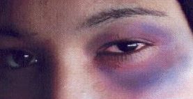 Plus de 620 femmes victimes de violence en 2009 à Oran