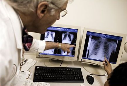 Tuberculose : 20 000 nouveaux cas annuellement en Algérie