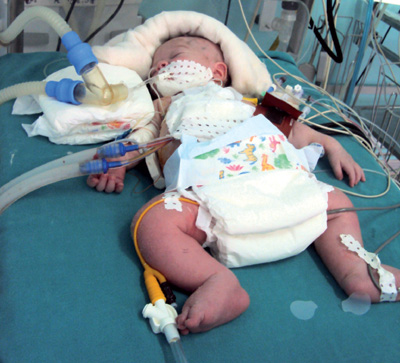 Un bébé de 11 jours sauvé in extremis