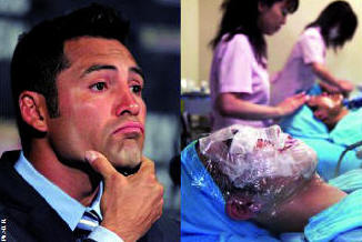 Chirurgie esthétique : Les Algériens de plus en plus soucieux de leur image