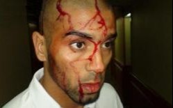 Les réactions à la sanction de l’Egypte