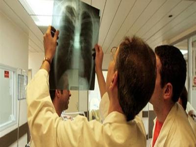 Cancers du poumon et du sein : des thérapies prometteuses