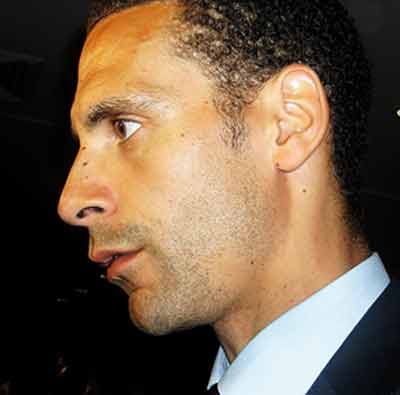 L’Angleterre perd Ferdinand