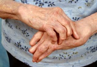 Journée d’information sur la polyarthrite : Une maladie invalidante mal appréhendée