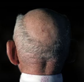 Retraités Algériens du régime Français,Les frais de mandat à leur charge