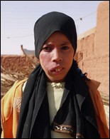 51 ans après le premier essai nucléaire français, des victimes algériennes racontent leurs souffrances