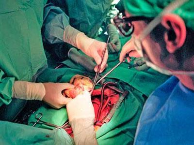 Don d&rsquo;organes: La Cnas accusée de faire du piston
