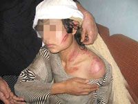 Durant les dix premiers mois de l&rsquo;année 2011, 7 500 femmes violentées