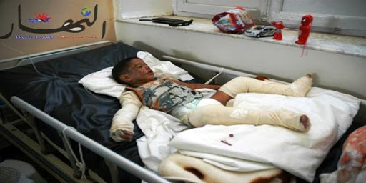 Expulsée de sa maison elle s’immole par le feu à Oran