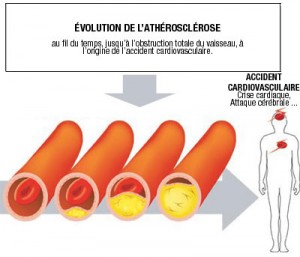 Les maladies cardiovasculaires, première cause de mortalité en Algérie