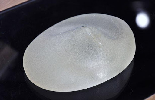 L&rsquo;Algérie n&rsquo;a pas importé officiellement la marque française de prothèses mammaires PIP