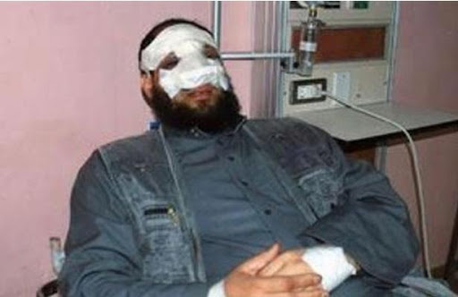 Egypte: Un député salafiste obligé de démissionner après une opération de chirurgie esthétique