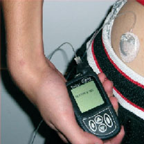 Le diabète chez l’enfant : La pompe à insuline meilleur remède