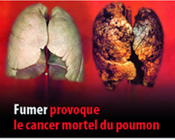 Tabagisme,Une personne meurt toutes les 6 secondes