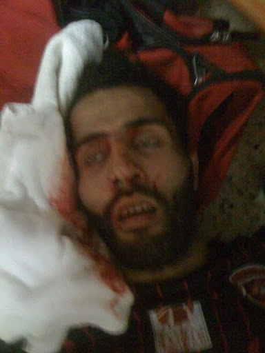 Drame de Saïda : Khaldi allume la mèche les voyous se chargent du reste