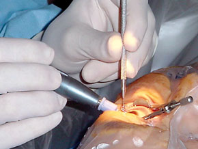 Greffe d’organes : l’Algérie a besoin de 2000 cornées à implanter