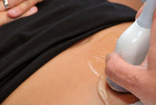 Infertilité : changer quelques habitudes suffit à tomber enceinte