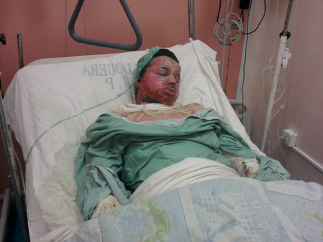 Tiaret: Un lycéen s&rsquo;immole par le feu à l&rsquo;intérieur de la classe