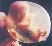 Le tabou qui l’entoure ne l’empêche pas de proliférer Avortement : un phénomène qui prend de l’ampleur