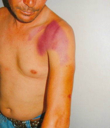 Après avoir été tabassé pour n’avoir pas respecté le jeûne, Slimane Rebaïne interrogé par la police