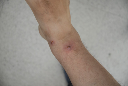 Les moustiques font fuir 6.000 employés du complexe des véhicules industriels de Rouiba