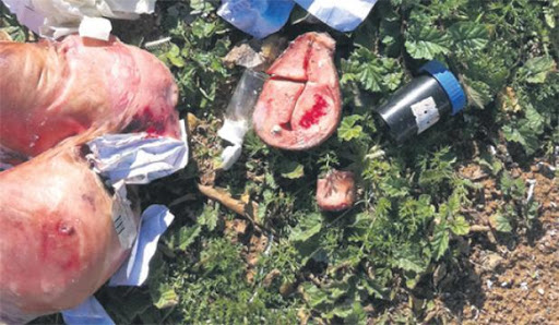 Mostaganem: La clinique jetait des restes humains dans une décharge