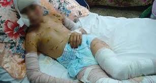 Oran: 1.693 enfants victimes d’accidents divers en un mois