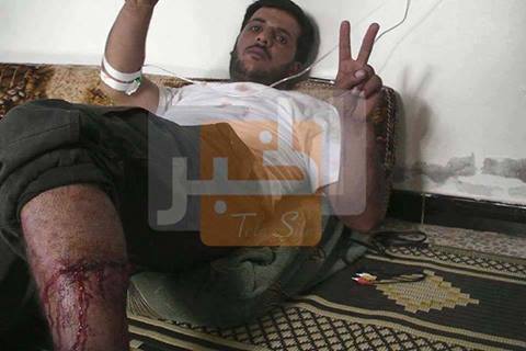 Le mercenaire cannibale blessé à Al-Qusseir