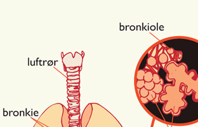 Oran, Cancer des poumons : plus de 600 nouveaux cas enregistrés