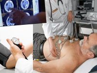 L’AVC, une pathologie fréquente et grave Une prédominance masculine de 62%