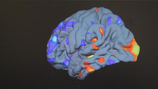 La génétique et l’image 3D au secours des autistes