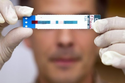 Sida: des cas de guérison très prometteurs