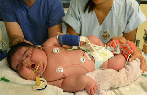 Un bébé de 6,11 kilos voit le jour en Allemagne