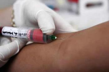 Durant les sept premiers mois de 2013,62 séropositifs et 10 cas de sida enregistrés