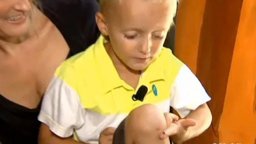 Etats-Unis : un escargot naît dans son genou, il l&rsquo;adopte