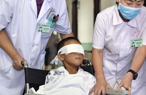 Chine: L&rsquo;enfant énucléé équipé ce mardi d&rsquo;un implant oculaire