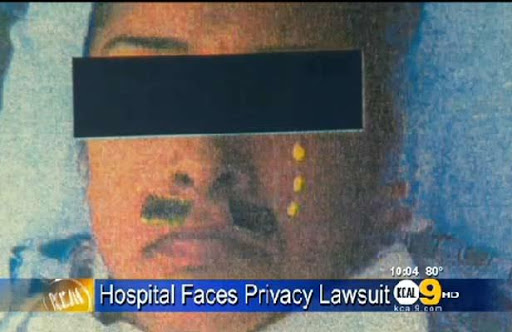 Elle poursuit l’hôpital et l’anesthésiste qui lui a collé une fausse moustache pendant son opération