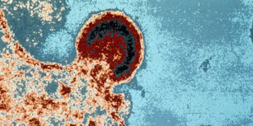 Réduire la propagation du sida par la circoncision ?