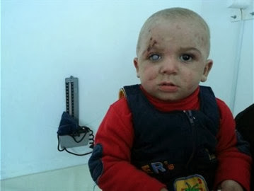 Syrie : enterré avec sa mère, il est retiré in extrémis de la tombe