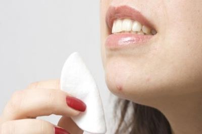 Mon acné me gâche la vie