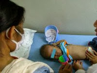 L’Algérie a élaboré sa stratégie nationale d’élimination de la transmission mère-enfant du virus du SIDA (OMS)