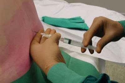 L’accouchement sans douleur : les différentes méthodes d’anesthésie