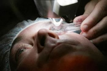 ORAN, 200 greffes de la cornée prévues en 2014