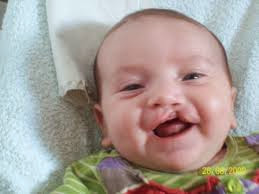 14 Algériens présentant des malformations de la lèvre opérés sur un porte-avions italien