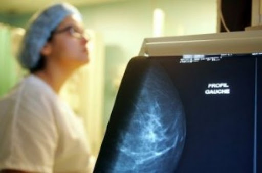 Le dépistage précoce, l&rsquo;arme la plus efficace pour lutter contre le cancer du sein (rencontre)