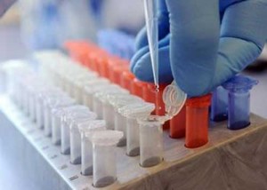 Vers la mise en service d&rsquo;un « laboratoire de haute sécurité pour les virus émergents »