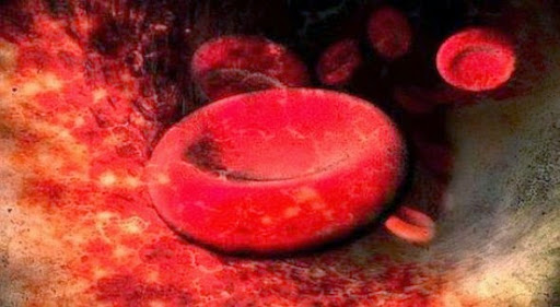 Nécessité de diagnostiquer la thalassémie avant le mariage (hématologues)